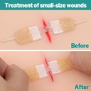 azen-12-pack-emergency-wound-closure-str-4.jpg