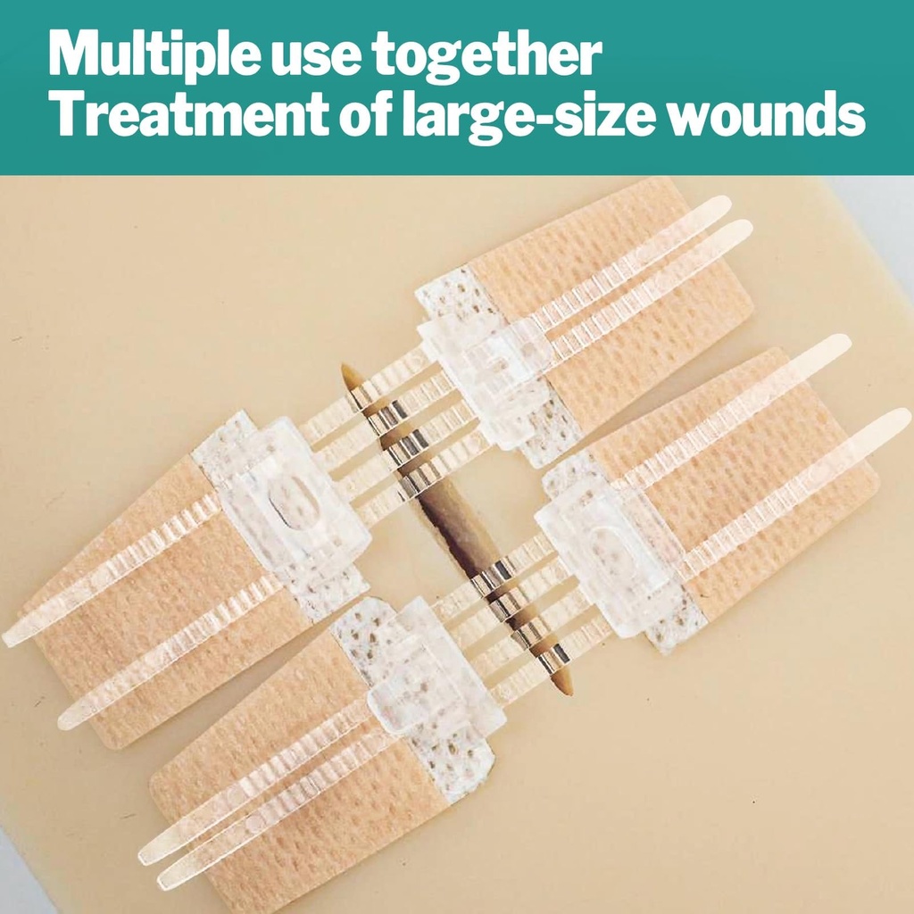 azen-10-pack-emergency-wound-closure-str-4.jpg