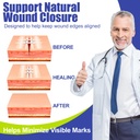 wound-closure-strips-for-skin-40-pack-st-4.jpg