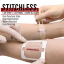everlit-wound-closure-pack-4-pcs-surgica-3.jpg