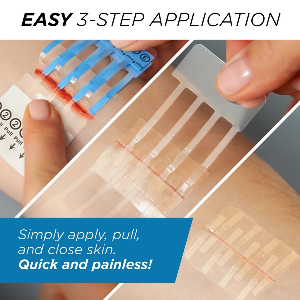 clozex-emergency-laceration-kit-repair-w-5.jpg