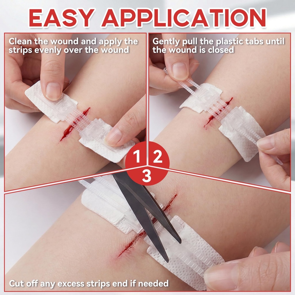 3-pcs-wound-closure-strips-for-emergency-3.jpg