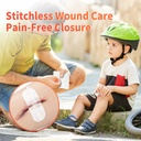 rhino-rescue-wound-closure-device-withou-2.jpg