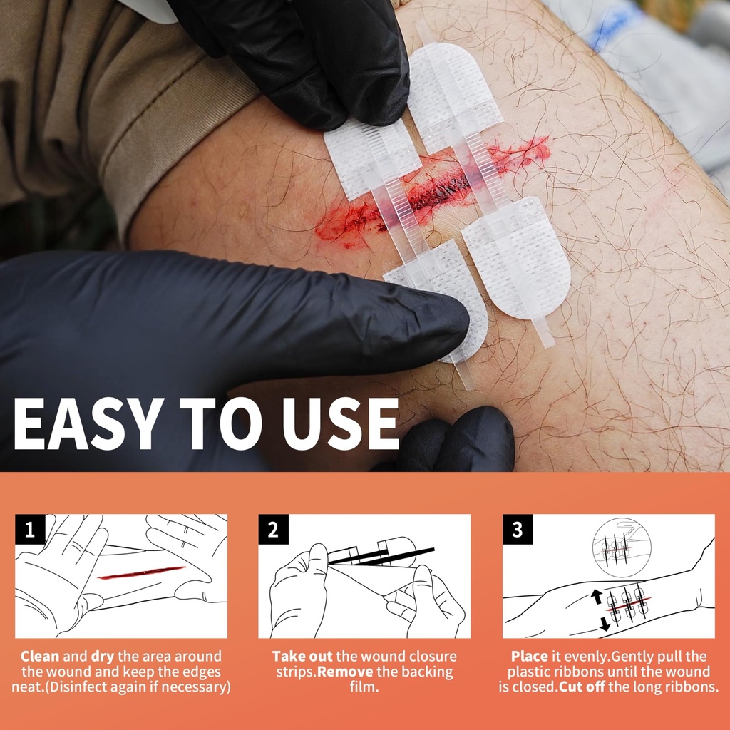 rhino-rescue-wound-closure-device-withou-3.jpg
