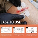 rhino-rescue-wound-closure-device-withou-3.jpg