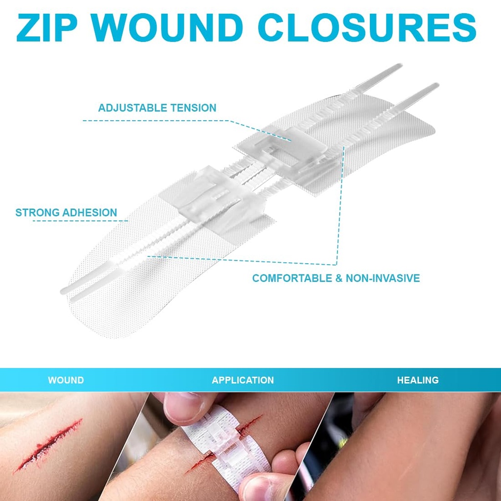 wound-closure-strips-sterile-skin-wound--3.jpg