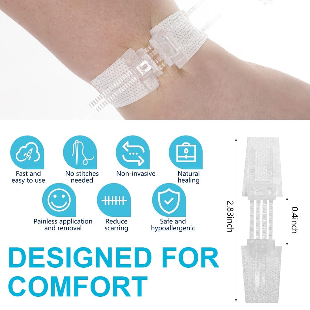 wound-closure-strips-sterile-skin-wound--2.jpg