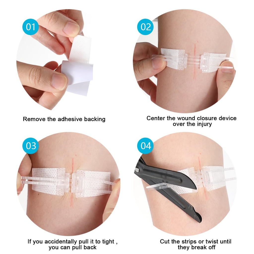 wound-closure-strips-sterile-skin-wound--4.jpg