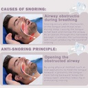 snoring-solution-anti-snoring-devices-2p-5.jpg