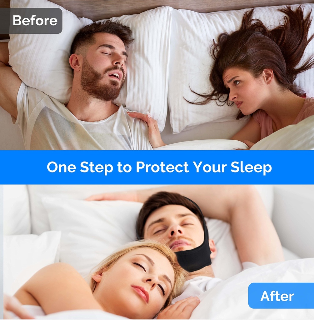 anti-snoring-chin-strap-anti-snoring-dev-5.jpg