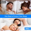 anti-snoring-chin-strap-anti-snoring-dev-5.jpg