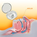 30pcs-anti-snore-kit-nose-vents-clips-na-4.jpg