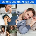 60-300count-new-happy-nasal-strips-nose--6.jpg