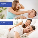 anti-snoring-devices-anngola-snoring-sol-5.jpg