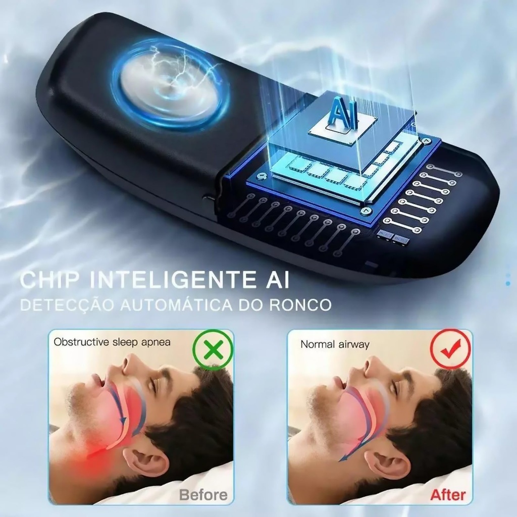 anti-snoring-device-intelligent-snoring--4.jpg
