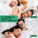nasal-strips-for-snoring-reusable-nose-s-3.jpg