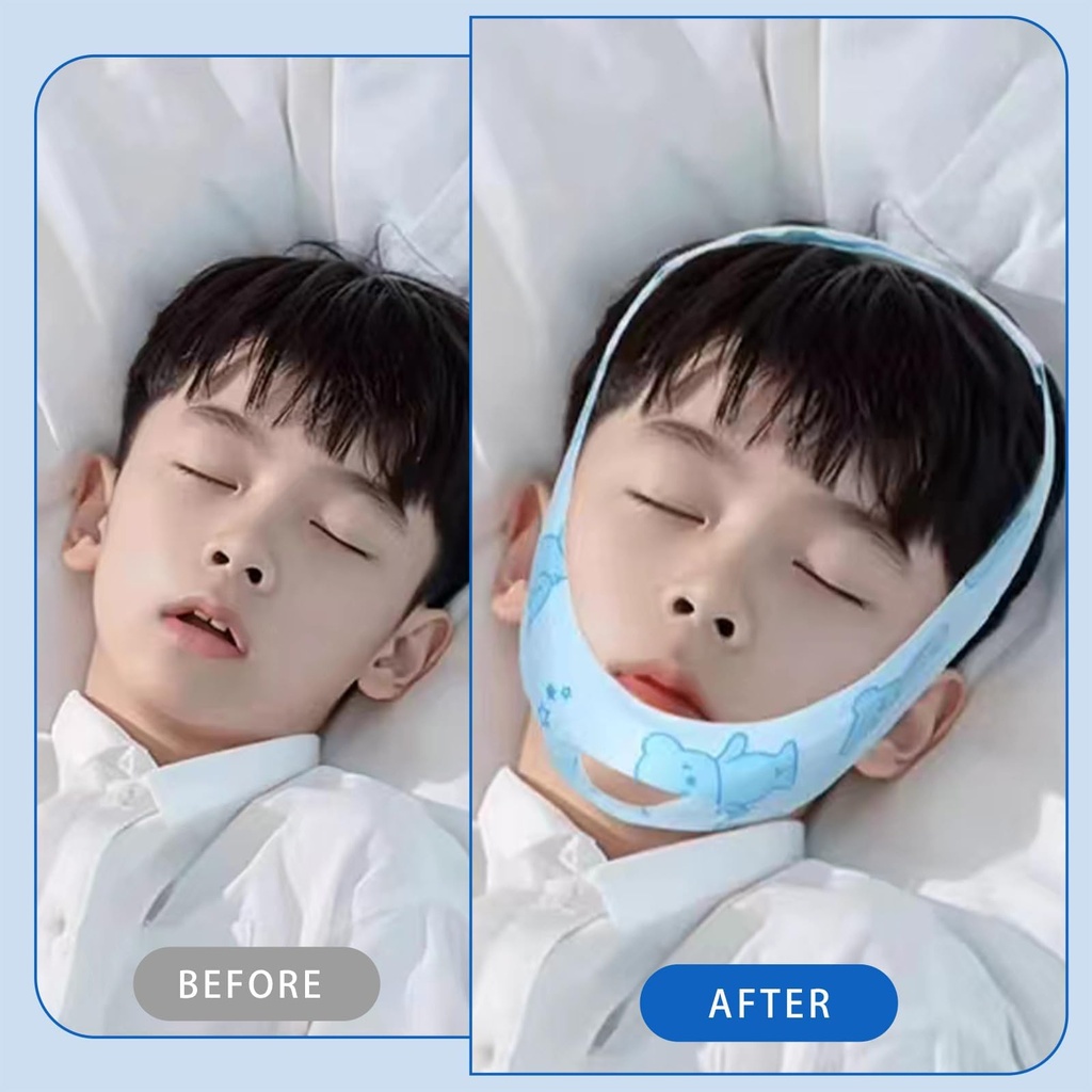 chin-strap-for-sleeping-kids-professiona-5.jpg
