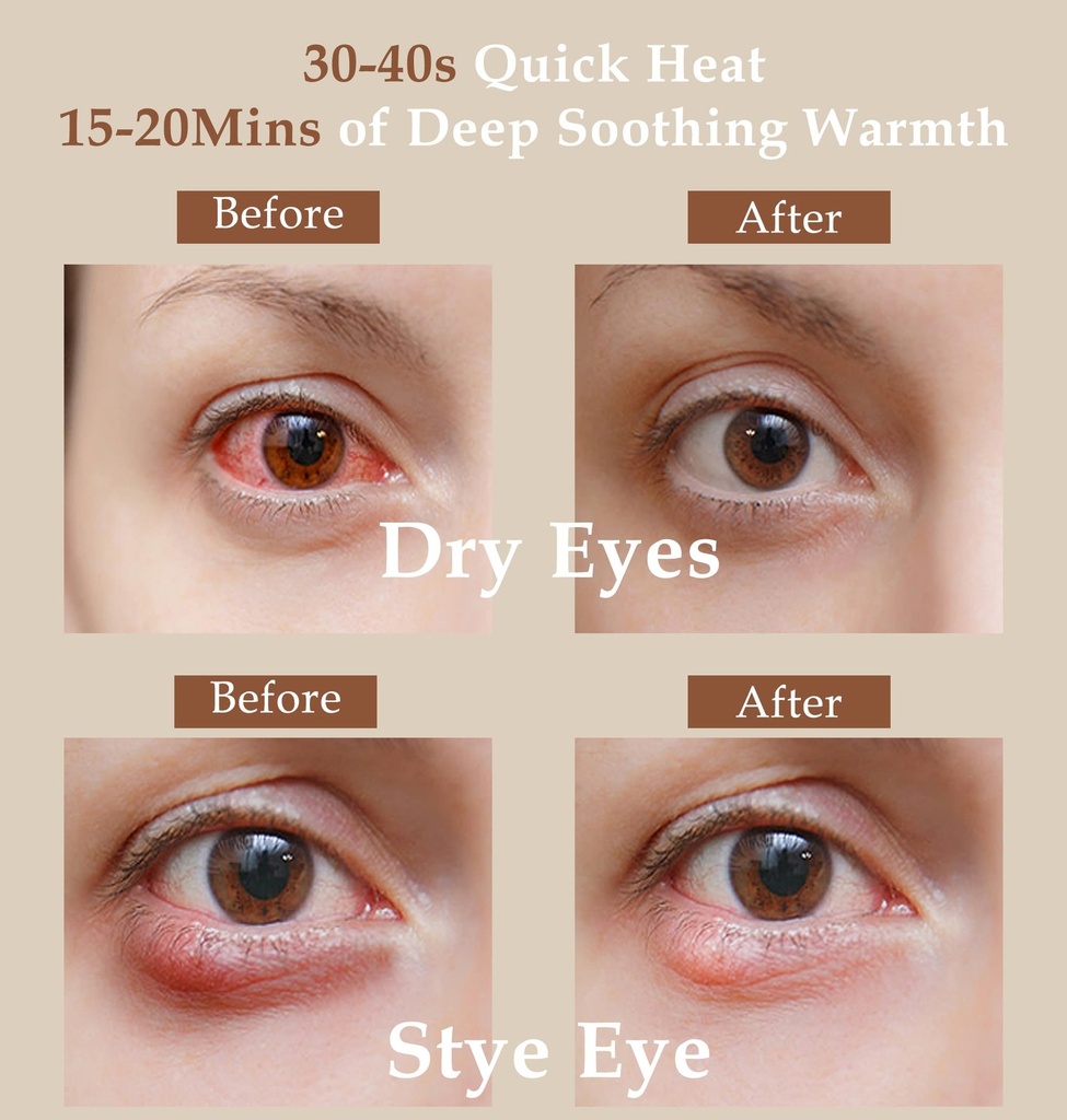 heated-eye-mask-2-packs-moist-warm-compr-3.jpg