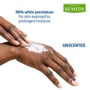 medline-remedy-essentials-ointment-7-oz--3.jpg