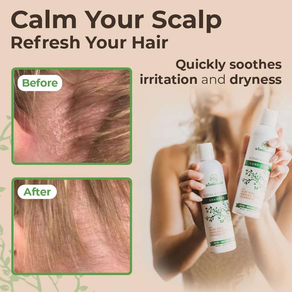 eczema-and-psoriasis-deep-conditioning-t-6.jpg