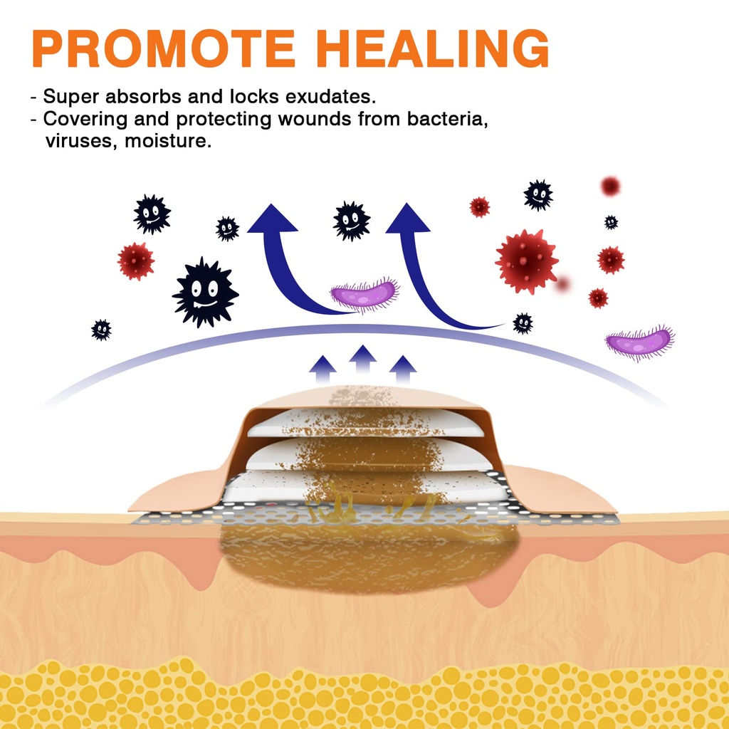 carbou-silicone-foam-dressing-with-gentl-4.jpg