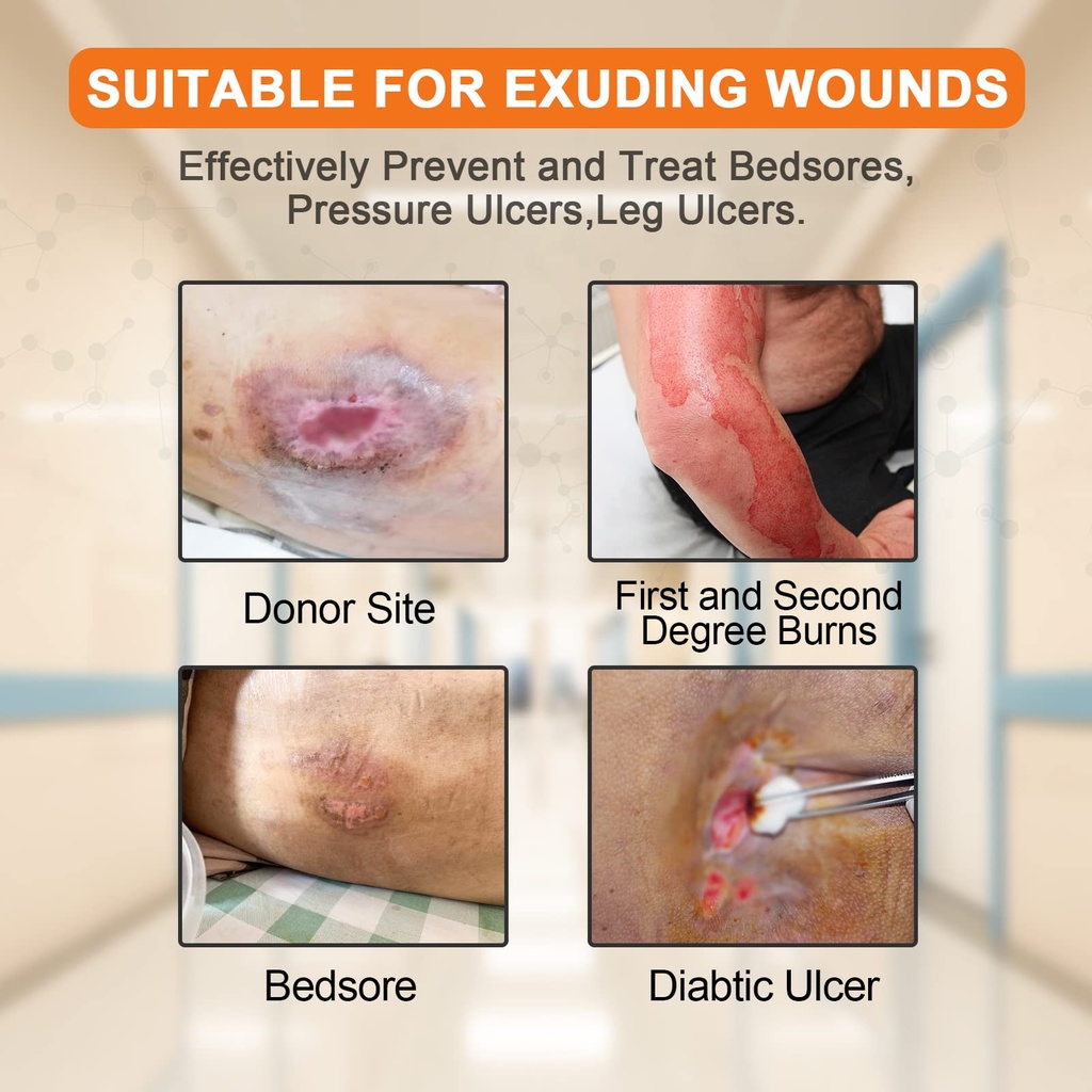 carbou-silicone-foam-dressing-with-gentl-3.jpg