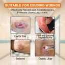 carbou-silicone-foam-dressing-with-gentl-3.jpg