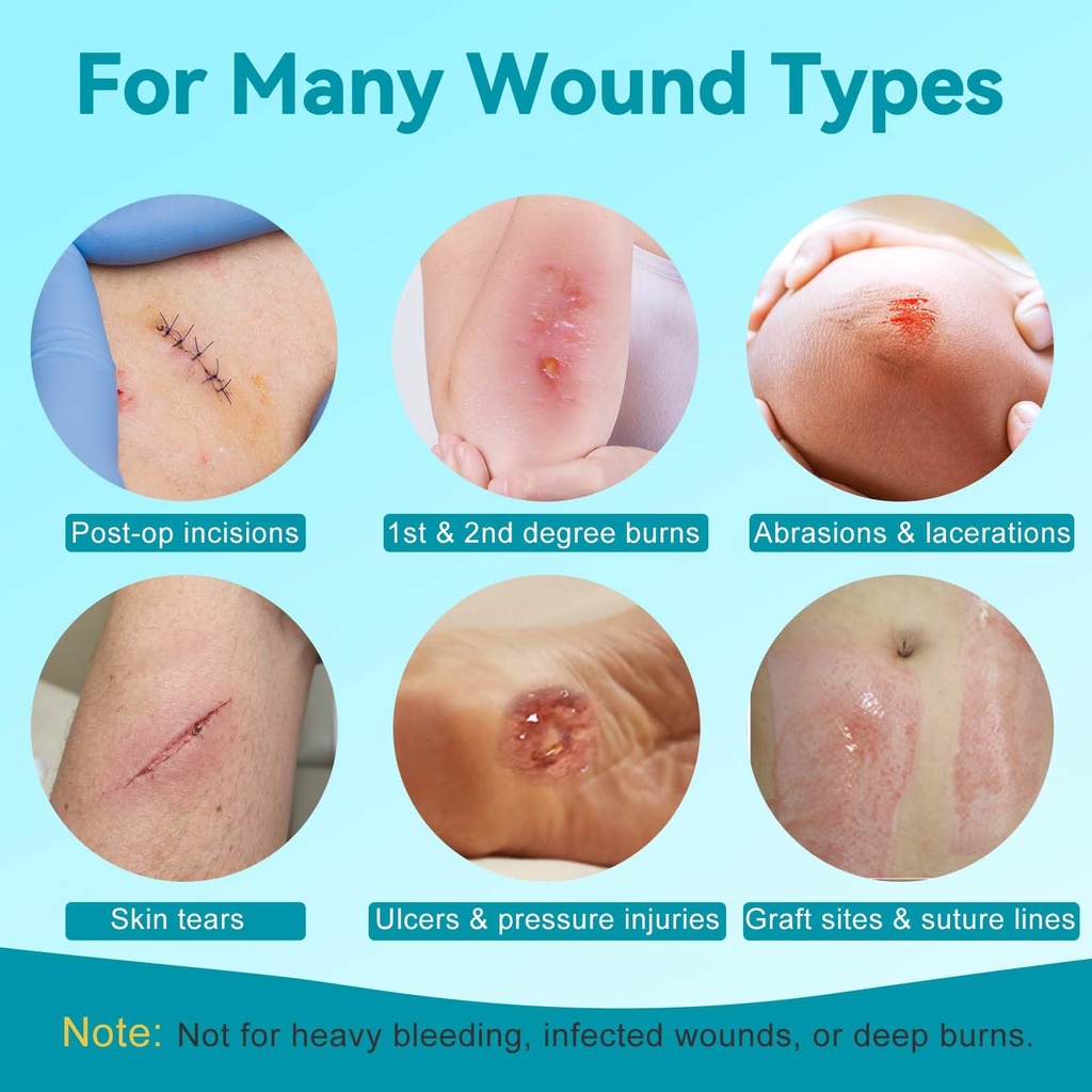 dimora-wound-contact-layer-silicone-dres-5.jpg