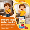 d-mannose-with-cranberry-gummies-for-kid-4.jpg