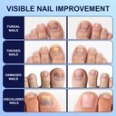 toenail-fungus-treatment-extra-strength--3.jpg