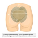 sacral-foam-wound-dressing-pressure-adhe-2.jpg