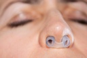 nostril-retainer-nostril-shaping-after-s-4.jpg