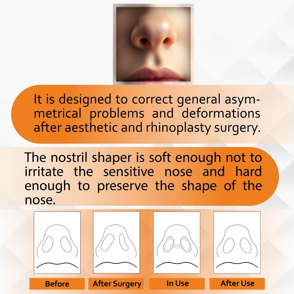 nostril-retainer-nostril-shaping-after-s-6.jpg