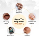 miduty-liposomal-vitamin-c-supplement-an-61aY3w0rT1L.jpg