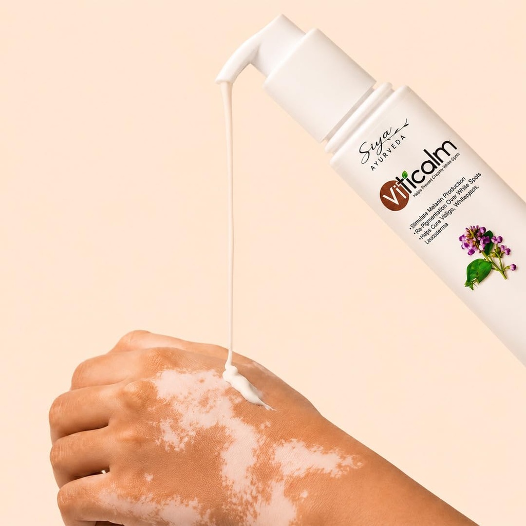 siya-ayurveda-vitiligo-white-spot-care-c-51Wdz9TfvFL.jpg