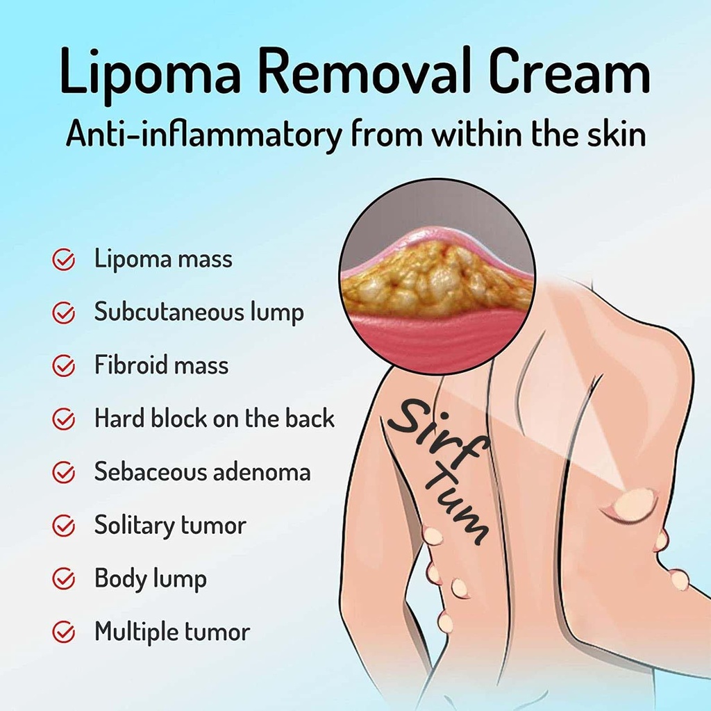 lipoma-removal-cream-whole-body-lipoma-l-71Y+6pJLwcL.jpg