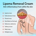 lipoma-removal-cream-whole-body-lipoma-l-71Y+6pJLwcL.jpg