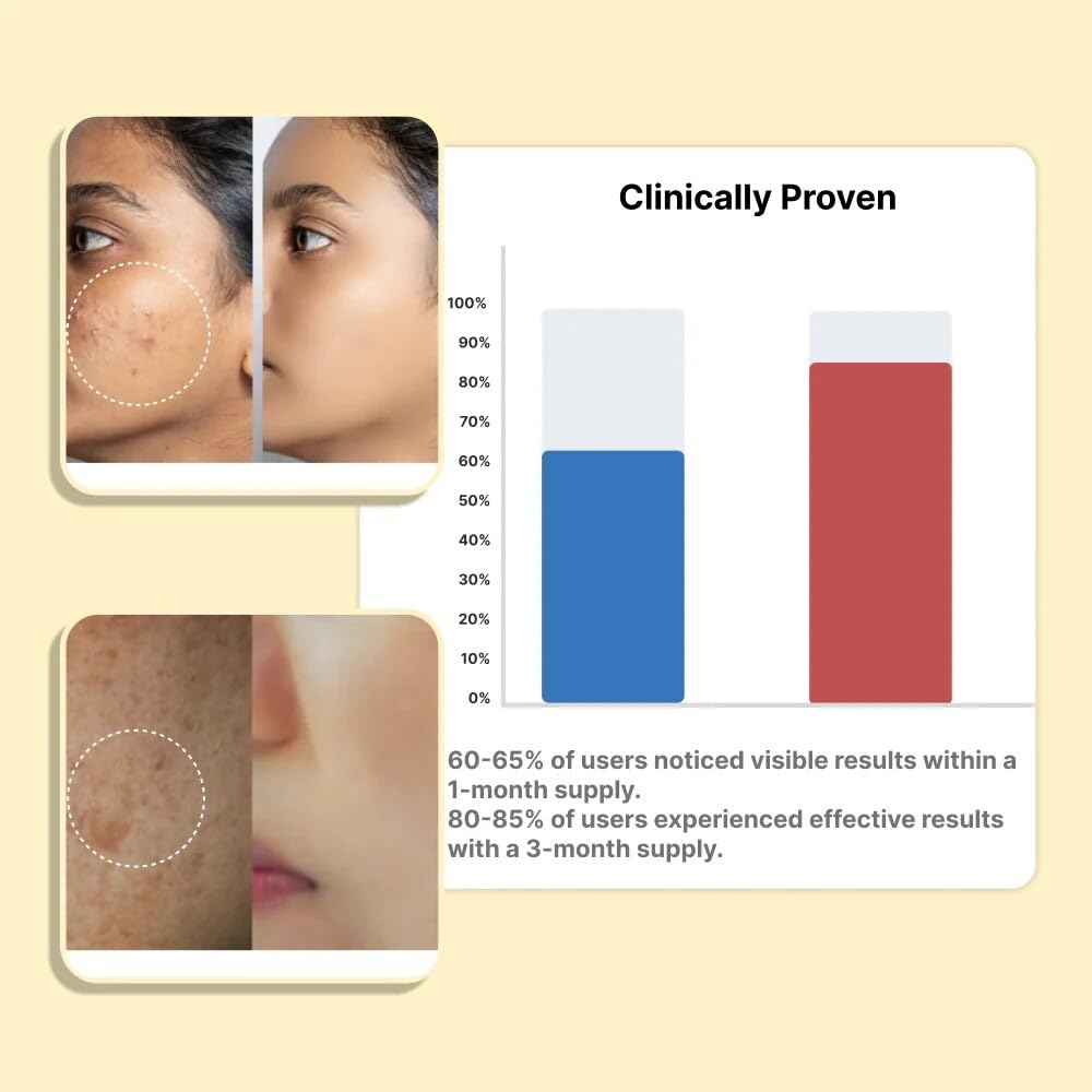 roopayur-collagen-booster-capsules-for-g-51-ZX4cfglL.jpg