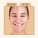 vitamin-c-face-serum-10ml-with-niacinami-715uAkYXOyL.jpg