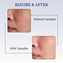 vantalite-l-glutathione-tablets-for-skin-51gXyOJA2SL.jpg