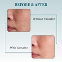 vantalite-l-glutathione-tablets-for-skin-51JYQeOKgxL.jpg
