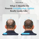 men-s-hair-growth-tablets-biotin-dht-blo-810Hy+XYuTL.jpg