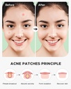 vowel-s-acne-pimple-patch-hydrocolloid-a-71PU911wo0L.jpg