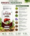liver-care-capsule-ayurvedic-fatty-liver-715vJTpGvbL.jpg