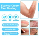 healmusz-eczema-relief-creamy-body-oil-p-2.jpg