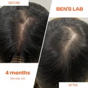 bens-lab-hair-growth-thickness-supplemen-5.jpg