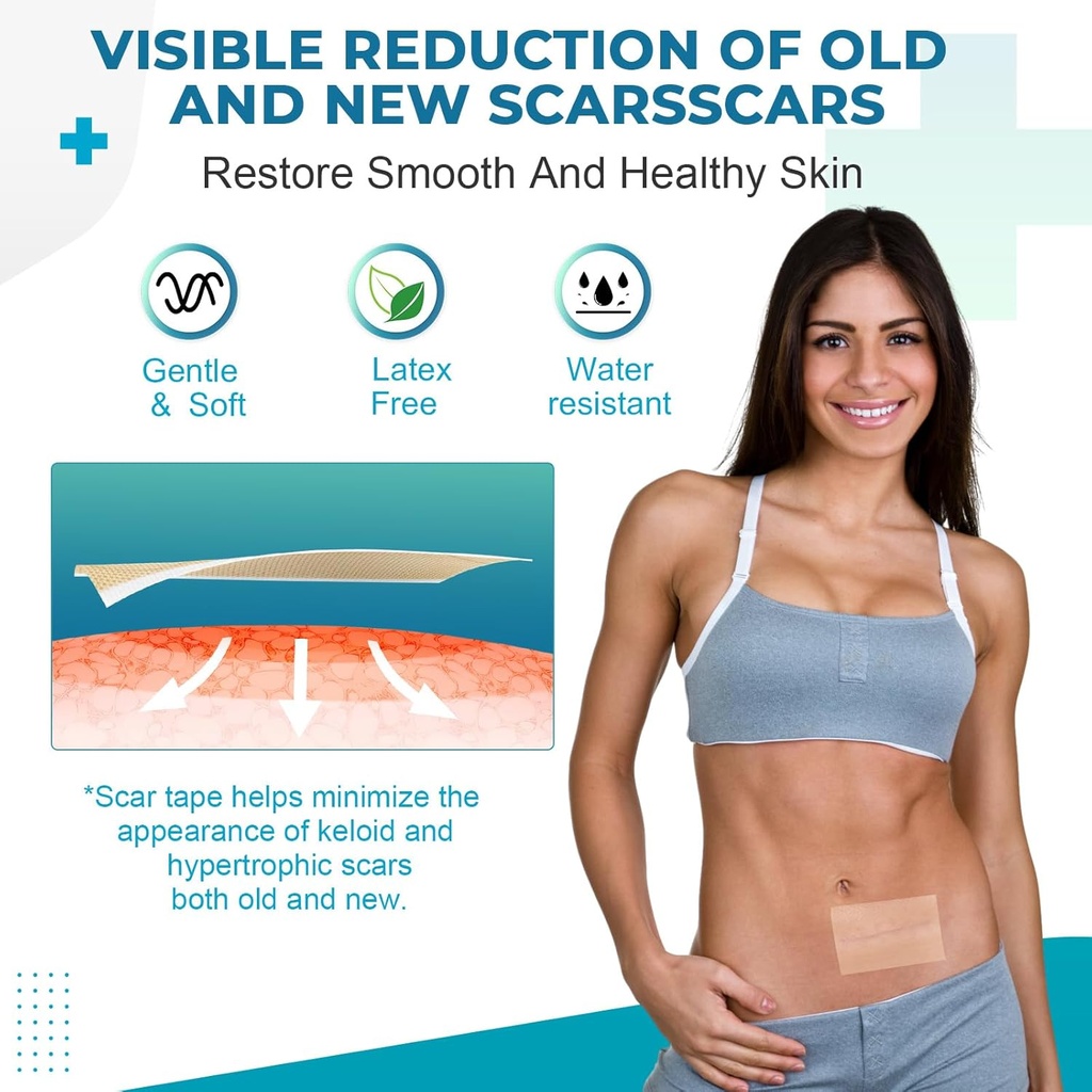 silicone-scar-sheets-silicone-scar-tape1-5.jpg