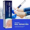 nail-fungus-pen-toenail-fungus-pen-treat-3.jpg