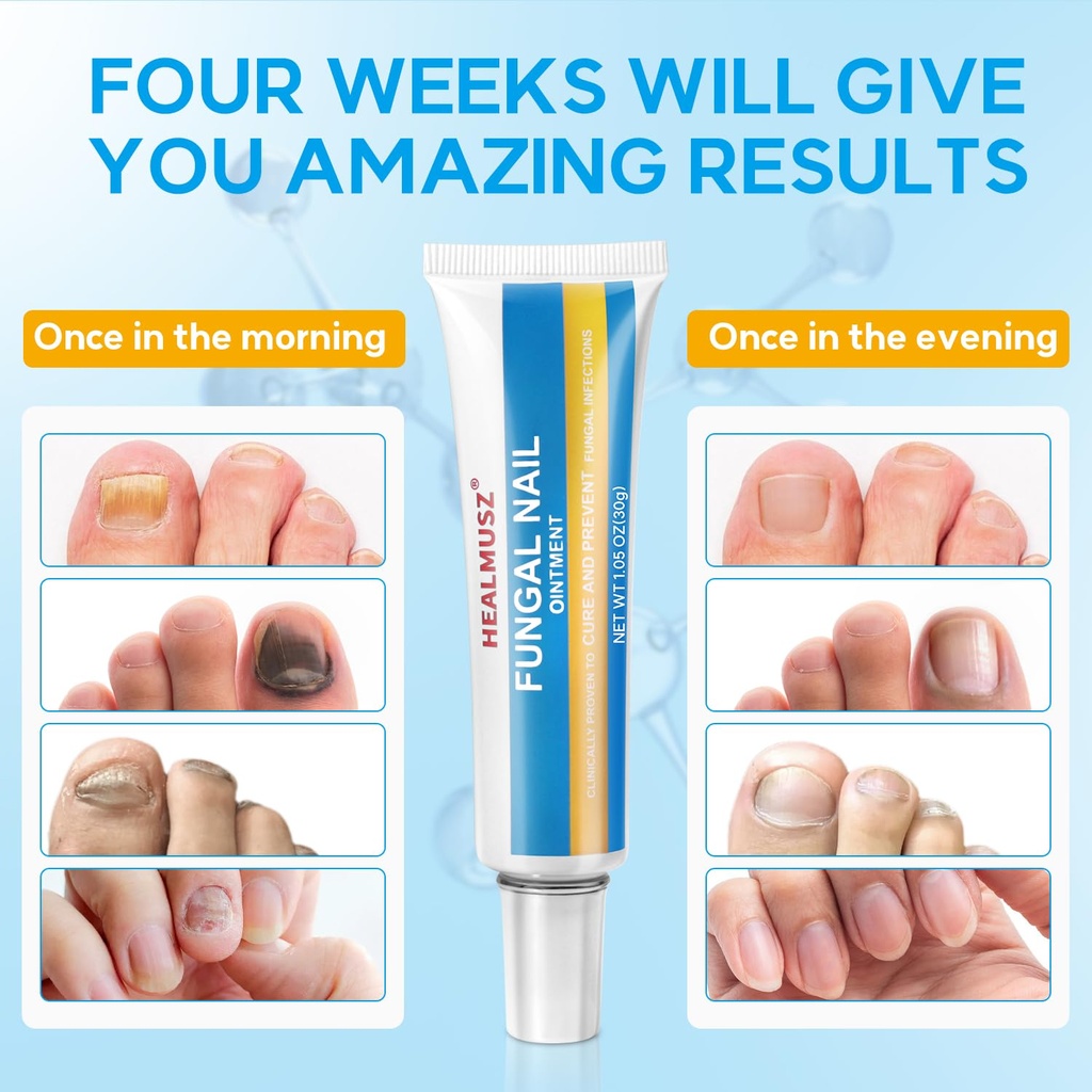 healmusz-toe-nail-fungus-ointment-antifu-5.jpg