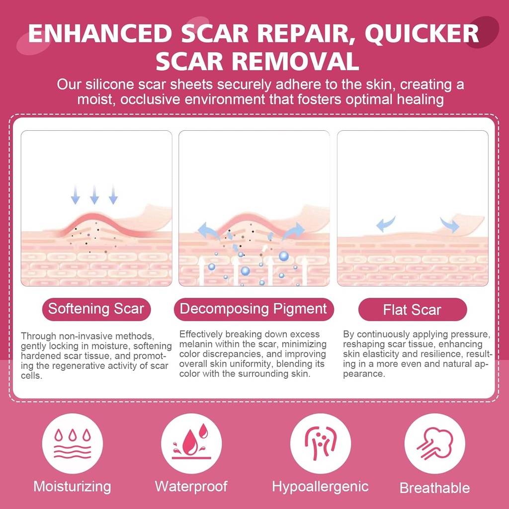 silicone-scar-sheetssilicone-scar-tape-f-4.jpg